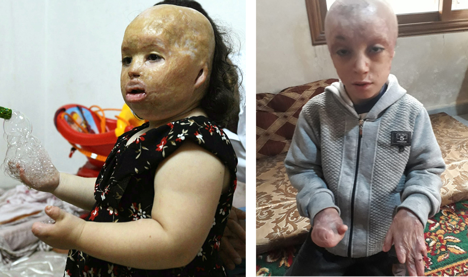 Help-Samira-And-Abdullah-To-Receive-Medical-Treatment-Campaign-1
